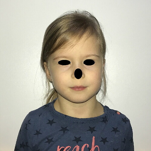 113